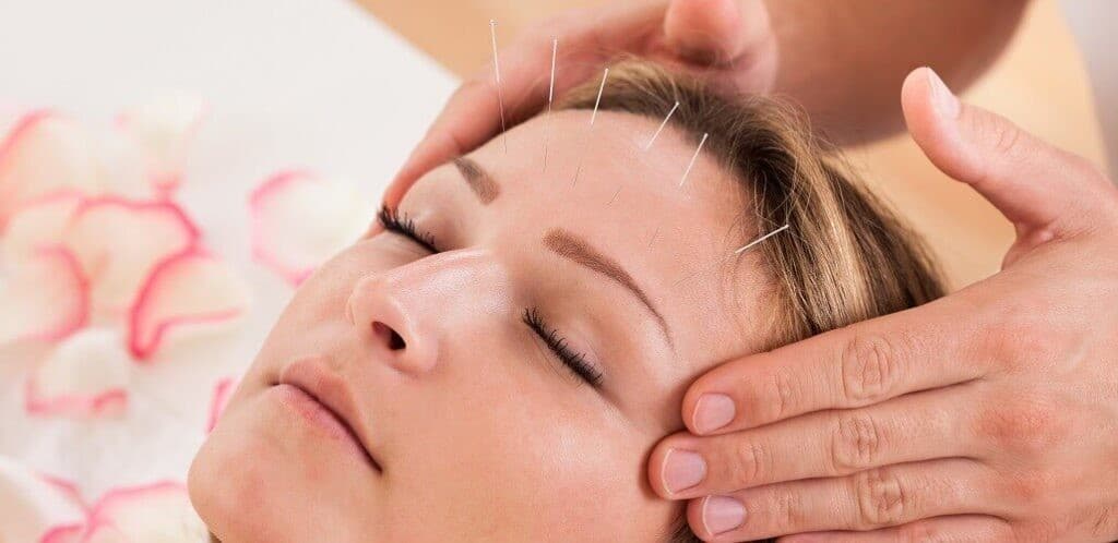 Image representing acupuncture.