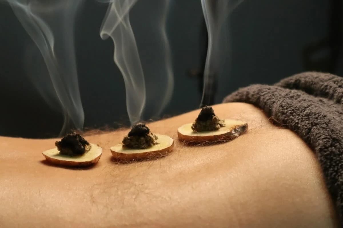 Image representing moxibustion.